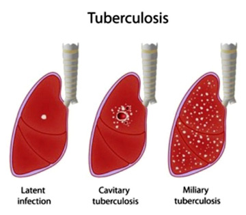 [Health Wise]